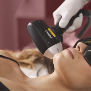 ALMA LASERS EPILAZIONE SU ZONE MINI 6 SEDUTE