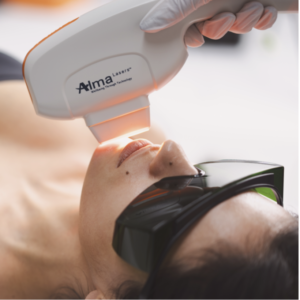 5 sedute Alma Lasers ringiovanimento viso con NIR o Radiofrequenza